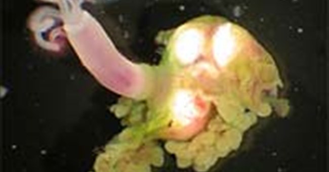 Loài giun ăn xương kỳ dị