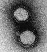 Vì sao virus cúm sinh sôi mạnh vào mùa đông?