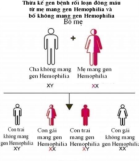 Rối loạn đông máu: Bệnh phải sống nhờ máu người khác