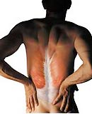 Người bị đau lưng nên đi bơi