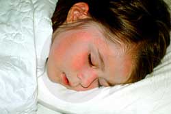 Thiếu ngủ ảnh hưởng xấu tới não của trẻ