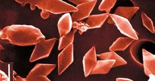 Dũng sĩ trừ sâu - Khuẩn Thuring (Bacillus thuringiensis)