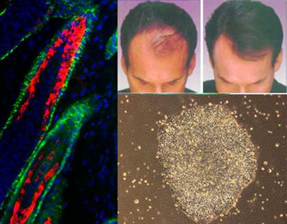 Tế bào gốc tạo tóc đã được kiểm chứng trên da chuột