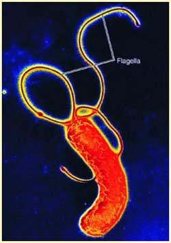 Vi khuẩn Helicobacter pylori chuyên quấy rối đường ruột con người