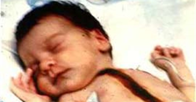 Cấy ghép cơ quan giữa các loài