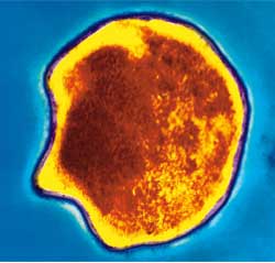 Giải Nobel y sinh học năm 2005 - Một cõi đi về với vi khuẩn