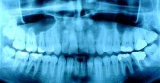 Áp dụng chất phóng xạ trong ngành Y và Sinh học