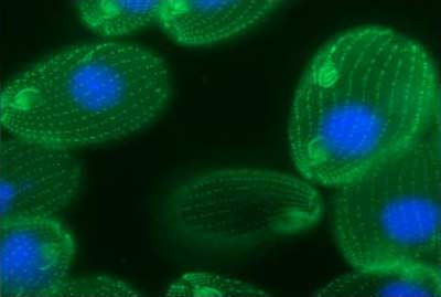 Một tế bào Tetrahymena thermophila có 25.000 gien