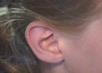 Liệu pháp hoóc-môn thay thế có thể ảnh huởng đến thính giác