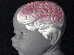 Não của trẻ 3 tháng tuổi cũng phức tạp như não người lớn?