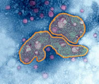 Tìm được lời giải vì sao H5N1 gây tử vong cao ở người