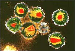 Đã theo dõi được hành trình của virus HIV vào tâm tế bào