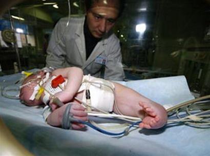 Trung Quốc: cứu sống một em bé “người cá”