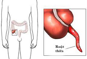 Ruột thừa có thừa không?