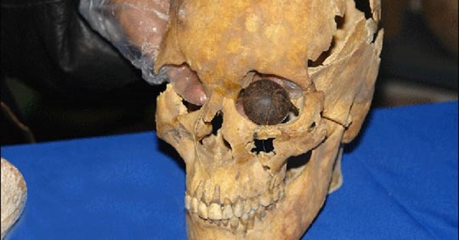 Mắt nhân tạo 4.800 tuổi được tìm thấy ở Iran