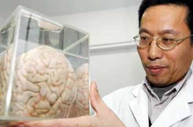 Người Trung Quốc sử dụng não như thế nào?