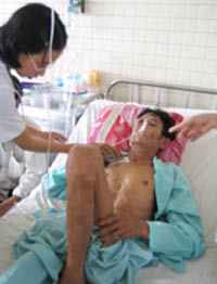 Phối tắc nghẽn mạn tính: 