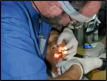 Hơn 75% người Việt từ 18 - 34 tuổi bị sâu răng
