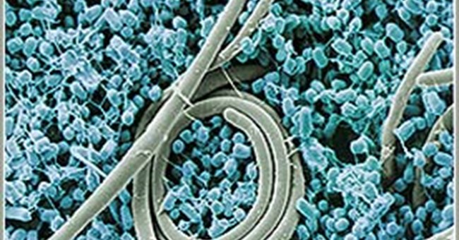 Rửa trứng bằng nước lạnh có thể giúp ngăn ngừa nhiễm khuẩn