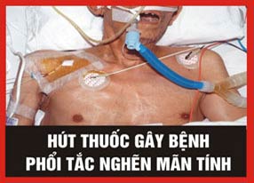 Năm hình ảnh cảnh báo phải in trên vỏ bao thuốc lá
