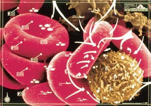 Sau 25 vì sao vẫn chưa tìm ra thuốc điều trị bệnh AIDS?