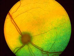 Mắt sinh học mang lại ánh sáng cho người mù