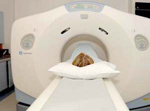 MRI có độ nhạy hơn CT trong chẩn đoán dạng đột quị cấp