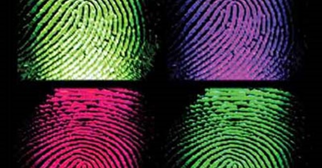 Không dấu vân tay - một rối loạn hiếm gặp