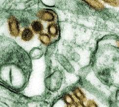 Đừng bỏ qua các chủng vi-rút cúm gia cầm ít độc hại