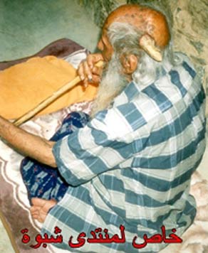 Chiếc sừng kỳ lạ của cụ già Yemen