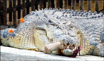 Nối tay bị cá sấu cắn đứt lìa