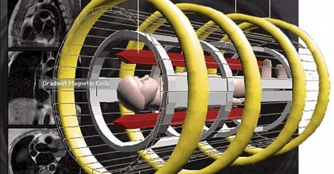 Thiết bị cộng hưởng từ đạt độ phân giải 90 nm