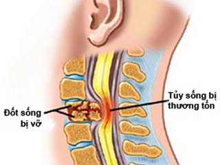Nano chữa bệnh: Hứa hẹn trị là hết