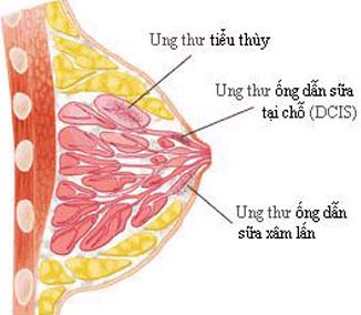 Nghiên cứu ung thư: Mô hình mới, không cần thử trên chuột