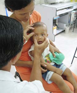 Báo động ung thư mắt
