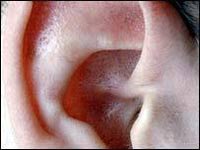 Kỹ thuật Implant mới giúp người điếc nặng nghe rõ