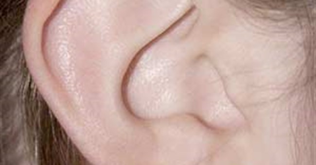 Phát hiện biến thể gien gây mất thính giác