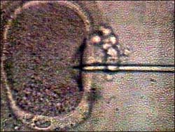Ca sinh đầu tiên từ một noãn bào chưa thành thục