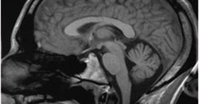 Các nhà khoa học tiết lộ “diện mạo” mới của trí nhớ