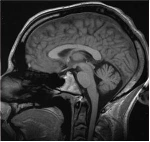 Các nhà khoa học tiết lộ “diện mạo” mới của trí nhớ