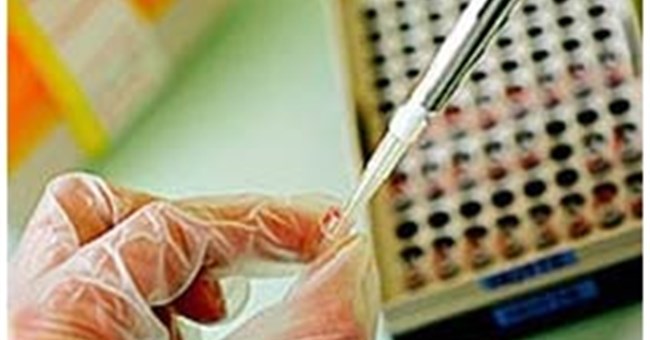 Phát hiện 2 gien gây bệnh đa xơ cứng