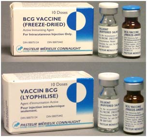 MVA85A: Vắc-xin mới ngừa bệnh lao