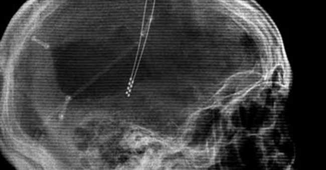 Đánh thức người sống thực vật