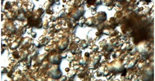 Giải mã bí ẩn của vi khuẩn sống nửa triệu năm