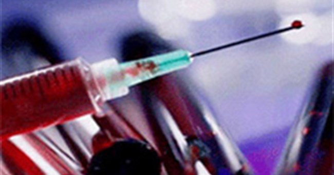 “Lắng nghe” tế bào để phát hiện bệnh Alzheimer