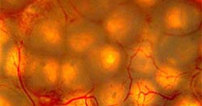 Cấy ghép tế bào heo để trị bệnh tiểu đường