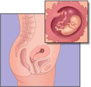 Phẫu thuật một thai nhi còn trong bụng mẹ