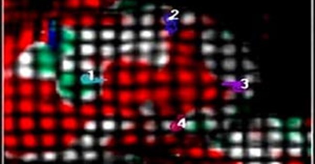 Lão hóa làm tim giảm khối lượng, bơm máu yếu