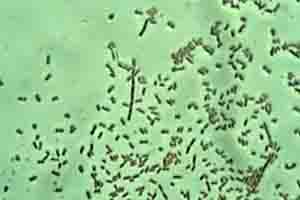 Vi khuẩn sinh sôi nhờ thuốc kháng sinh