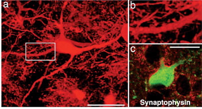 Phương pháp tế bào gốc giúp điều trị bệnh Parkinson ở loài chuột